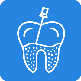 Root canal treatment in Mira road