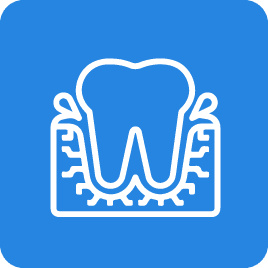 Periodontal treatment  in Mira road