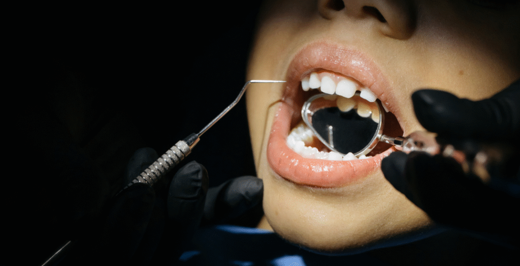 Full Mouth Rehabilitation