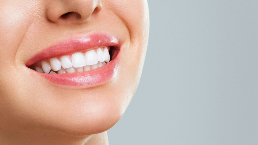 Achieving Smiling Teeth