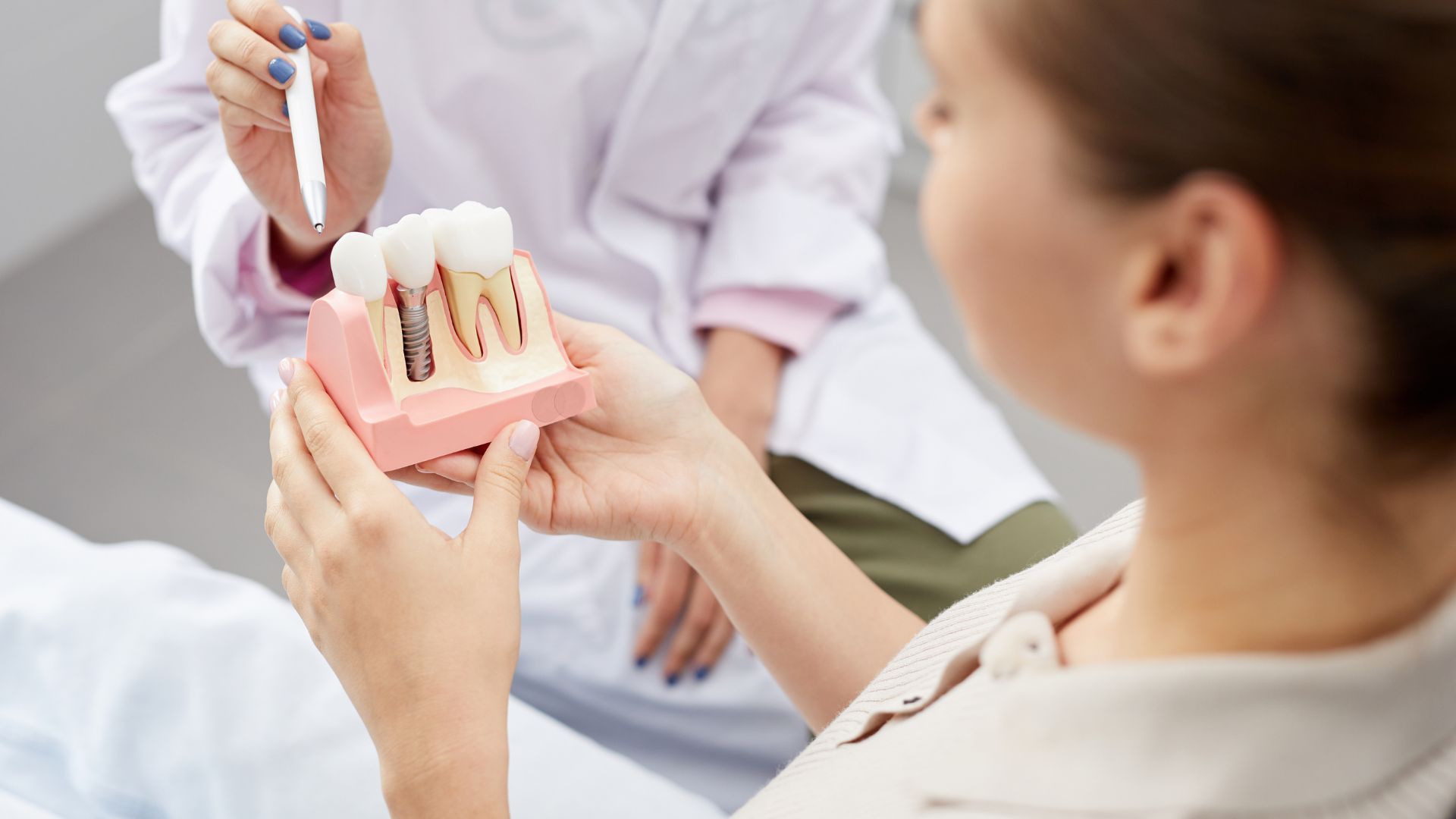 Dental Implant Complications: What You Should Know
