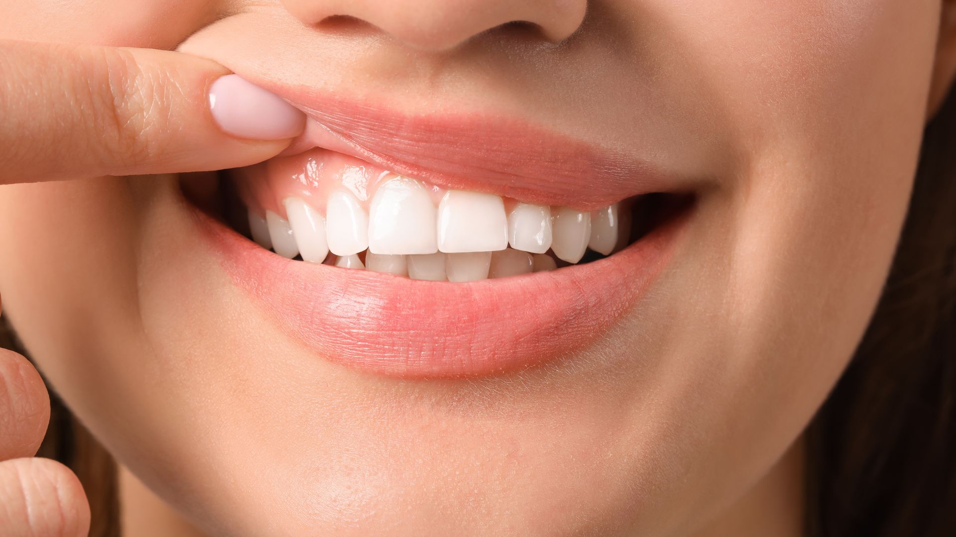 Dental Implants Fail