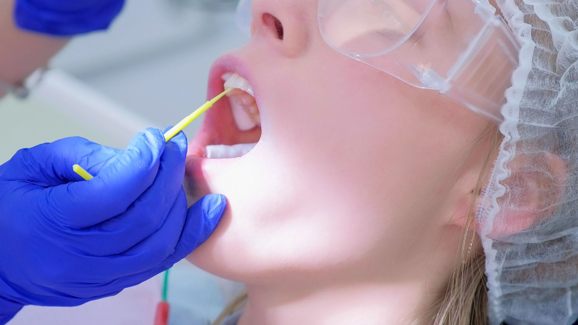Fluoride Treatment: Essential Protection for Teeth?
