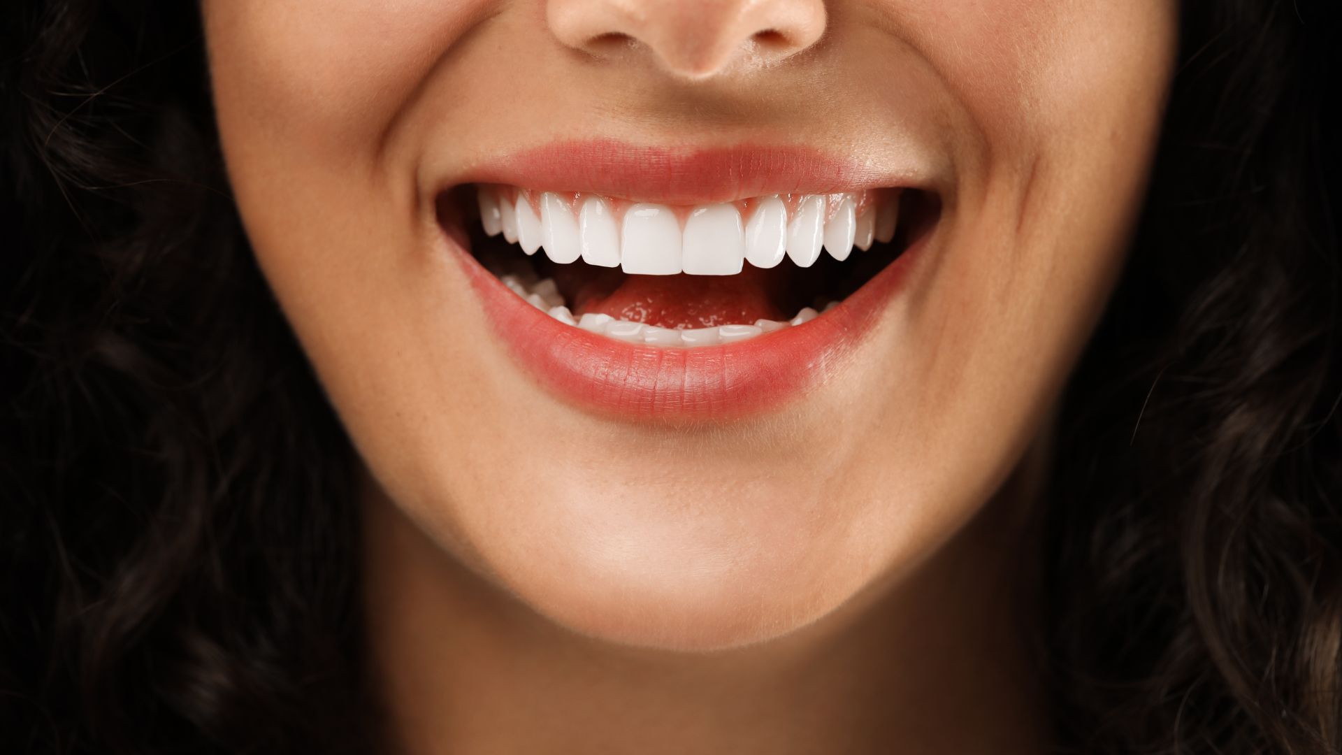 Cost Breakdown of Popular Cosmetic Dental Procedures