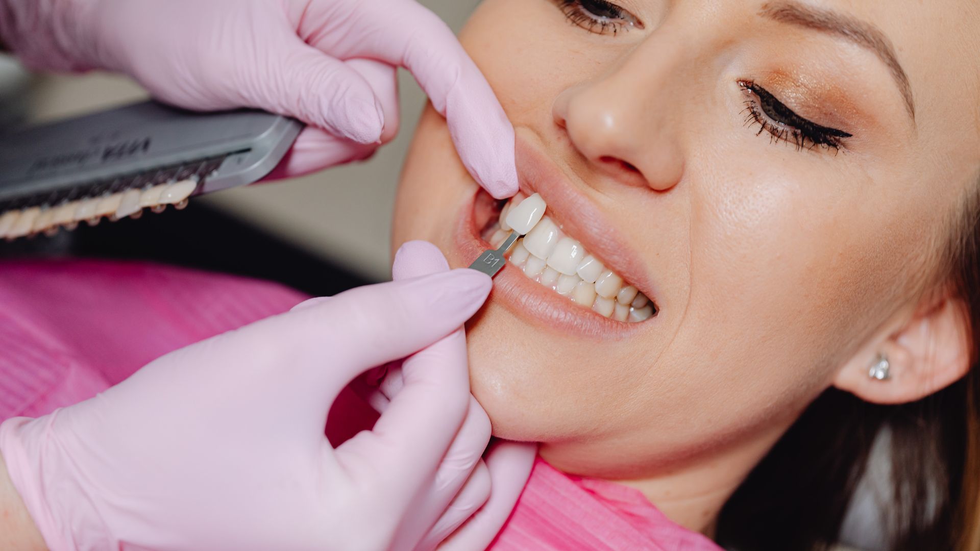 Pros and Cons of Composite Bonding